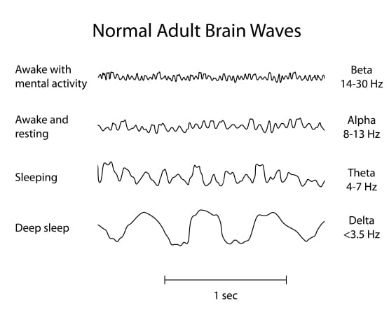 Normal-Adult-Brain-Waves_555x443